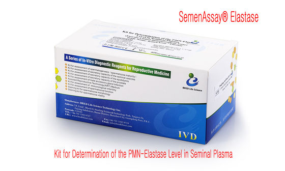 40T/কিট এসসিডি পদ্ধতি এবং সিই অনুমোদিত সঠিক ডিএনএ বিভাজন পরীক্ষার জন্য শুক্রাণু ডিএনএ বিভাজন কিট