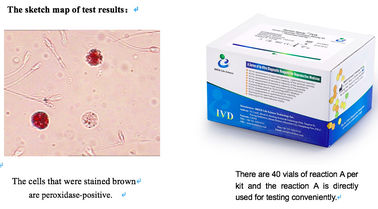 Semen Sample Leukocytes Test Kit 40T/Kit For Male Reproductive Tract Infection Screening