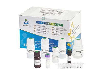 High Accuracy Male Fertility Test Kit 40T/Kit For Male Infertility Diagnosis